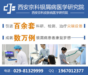 郑州牛皮癣治疗最好的医院