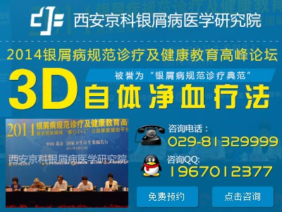 郑州哪个医院治牛皮癣较好