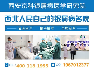牛皮癣治疗郑州最好的医院是哪家