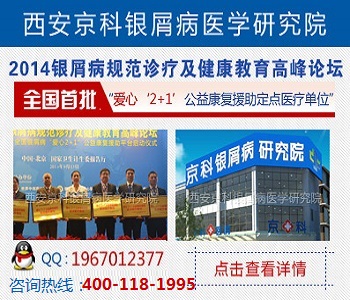 河南牛皮癣研究所