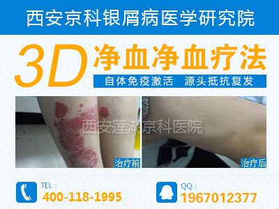 河南省牛皮癣研究所