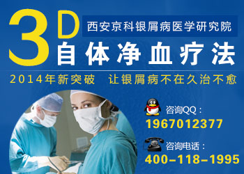 郑州哪家医院看银屑病最好